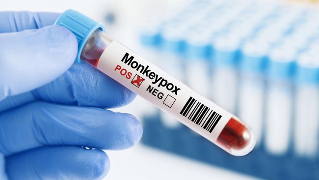 Kemenkes: Waspada Penularan Cacar Monyet dari Manusia ke Hewan